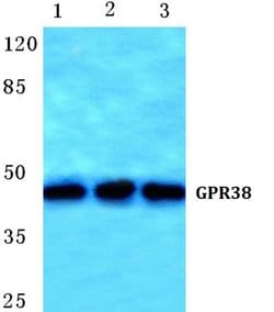 Invitrogen MLNR Polyclonal Antibody 100 &mu;L; Unconjugated:Antibodies,