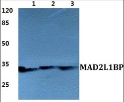 Invitrogen MAD2L1BP Polyclonal Antibody 100 &mu;L; Unconjugated:Antibodies,