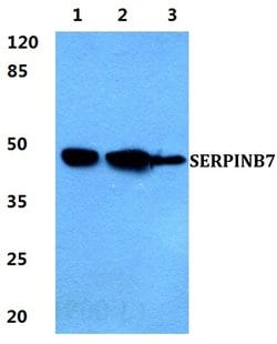 Invitrogen SERPINB7 Polyclonal Antibody 100 &mu;L; Unconjugated:Antibodies,