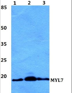 Invitrogen MYL7 Polyclonal Antibody 100 &mu;L; Unconjugated:Antibodies,