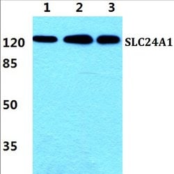 SLC24A1 Polyclonal Antibody:Antibodies, Polyclonal