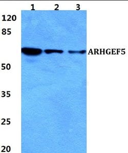 Invitrogen™ GEF5 Polyclonal Antibody