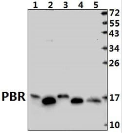 Invitrogen TSPO Polyclonal Antibody 100 &mu;L | Buy Online | Invitrogen&trade; | Fisher Scientific