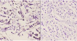 Pyruvate Carboxylase Polyclonal Antibody:Antibodies, Polyclonal
