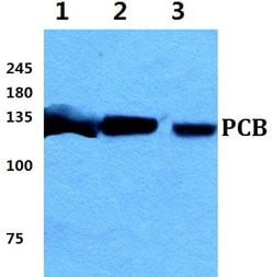 Pyruvate Carboxylase Polyclonal Antibody:Antibodies, Polyclonal