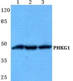 Invitrogen PHKG1 Polyclonal Antibody 100 &mu;L | Buy Online | Invitrogen&trade; | Fisher Scientific