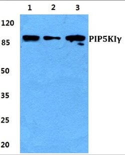 Invitrogen PIP5K1C Polyclonal Antibody 100 &mu;L; Unconjugated:Antibodies,