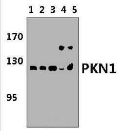 Invitrogen PKN1 Polyclonal Antibody 100 &mu;L | Buy Online | Invitrogen&trade; | Fisher Scientific