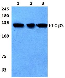 Invitrogen PLCB2 Polyclonal Antibody 100 &mu;L; Unconjugated:Antistoffer