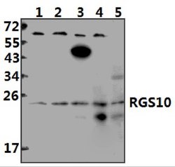 Invitrogen RGS10 Polyclonal Antibody 100 &mu;L; Unconjugated:Antibodies,