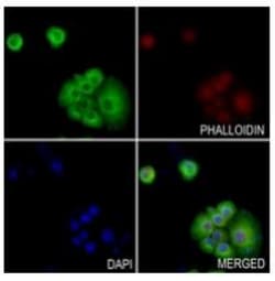 Invitrogen RGS5 Polyclonal Antibody 100 &mu;L | Buy Online | Invitrogen&trade; | Fisher Scientific