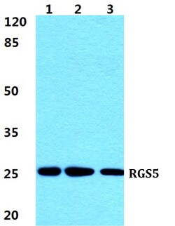 Invitrogen RGS5 Polyclonal Antibody 100 &mu;L | Buy Online | Invitrogen&trade; | Fisher Scientific