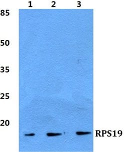 RPS19 Polyclonal Antibody:Antibodies, Polyclonal