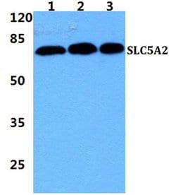 Invitrogen SGLT2 Polyclonal Antibody 100 &mu;L; Unconjugated:Antibodies,
