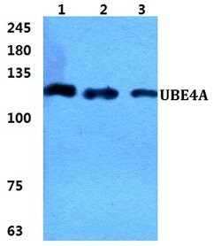 Invitrogen UBE4a Polyclonal Antibody 100 &mu;L | Buy Online | Invitrogen&trade; | Fisher Scientific