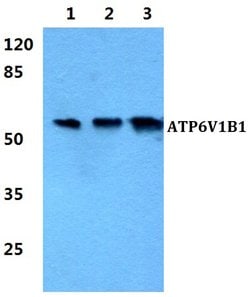 Invitrogen ATP6V1B1 Polyclonal Antibody 100 &mu;L; Unconjugated:Antibodies,