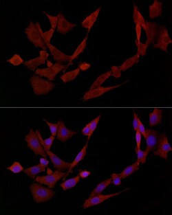 Invitrogen DOK4 Polyclonal Antibody 100 &mu;L | Buy Online | Invitrogen&trade; | Fisher Scientific
