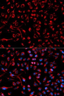 Invitrogen DOK4 Polyclonal Antibody 100 &mu;L | Buy Online | Invitrogen&trade; | Fisher Scientific