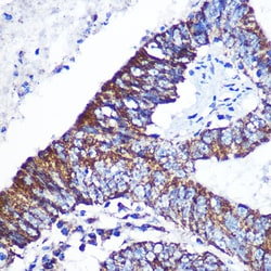 Invitrogen DOK4 Polyclonal Antibody 100 &mu;L | Buy Online | Invitrogen&trade; | Fisher Scientific