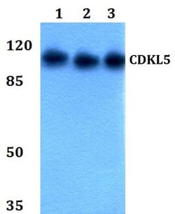 Invitrogen CDKL5 Polyclonal Antibody 100 &mu;L; Unconjugated:Antibodies,