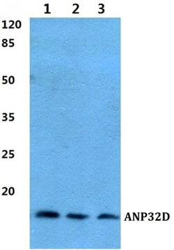 Invitrogen ANP32D Polyclonal Antibody 100 &mu;L; Unconjugated:Antibodies,