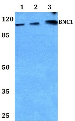 Invitrogen BNC1 Polyclonal Antibody 100 &mu;L; Unconjugated:Antistoffer