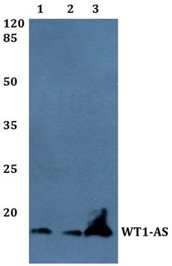 WT1-AS Polyclonal Antibody:Antibodies, Polyclonal