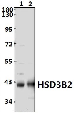 Invitrogen HSD3B2 Polyclonal Antibody 100 &mu;L; Unconjugated:Antibodies,