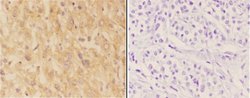 ASAH3 Polyclonal Antibody:Antibodies, Polyclonal
