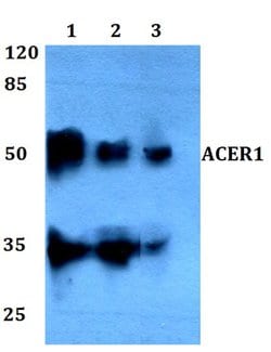 ASAH3 Polyclonal Antibody:Antibodies, Polyclonal