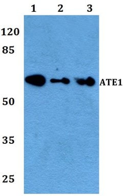 Invitrogen ATE1 Polyclonal Antibody 100 &mu;L; Unconjugated:Antibodies,
