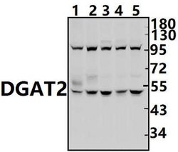 Invitrogen DGAT2 Polyclonal Antibody 100 &mu;L; Unconjugated:Antibodies,