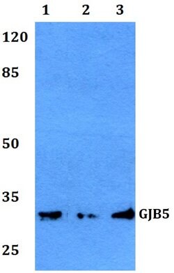 Invitrogen Connexin 31.1 Polyclonal Antibody 100 &mu;L; Unconjugated:Antibodies,