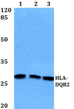 Invitrogen HLA-DQB2 Polyclonal Antibody 100 &mu;L; Unconjugated:Antibodies,