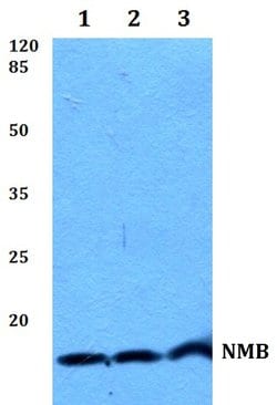 NMB Polyclonal Antibody:Antibodies, Polyclonal