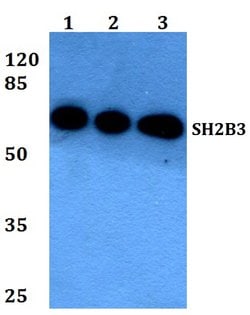 Invitrogen LNK Polyclonal Antibody 100 &mu;L; Unconjugated:Antibodies,