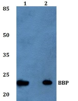 Invitrogen TM2D1 Polyclonal Antibody 100 &mu;L; Unconjugated:Antibodies,