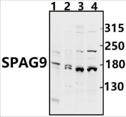 JLP Polyclonal Antibody:Antibodies, Polyclonal