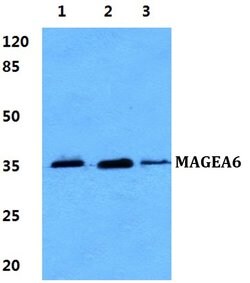 Invitrogen MAGEA6 Polyclonal Antibody 100 &mu;L; Unconjugated:Antibodies,