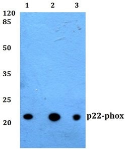 Invitrogen CYBA Polyclonal Antibody 100 &mu;L; Unconjugated:Antibodies,