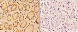 Invitrogen Angiopoietin 4 Polyclonal Antibody 100 &mu;L; Unconjugated:Antibodies,