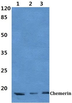 Chemerin Polyclonal Antibody:Antibodies, Polyclonal