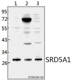 Invitrogen SRD5A1 Polyclonal Antibody 100 &mu;L; Unconjugated:Antibodies,