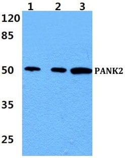 Invitrogen PANK2 Polyclonal Antibody 100 &mu;L; Unconjugated:Antibodies,