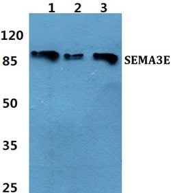 Invitrogen SEMA3E Polyclonal Antibody 100 &mu;L; Unconjugated:Antibodies,