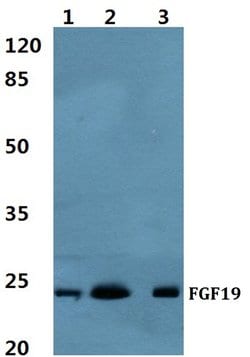 Invitrogen FGF19 Polyclonal Antibody 100 &mu;L; Unconjugated:Antibodies,