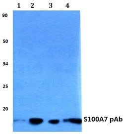 Invitrogen&trade;&nbsp;S100A7 Polyclonal Antibody
