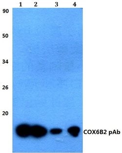 Invitrogen COX6B2 Polyclonal Antibody 100 &mu;L | Buy Online | Invitrogen&trade; | Fisher Scientific