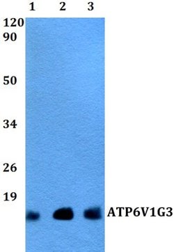 Invitrogen&trade;&nbsp;V-ATPase G3 Polyclonal Antibody