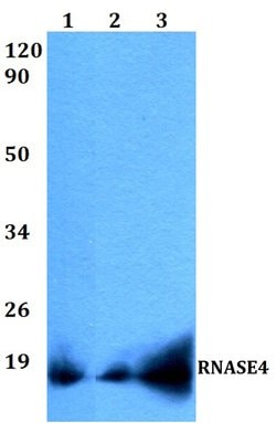 RNASE4 Polyclonal Antibody:Antibodies, Polyclonal